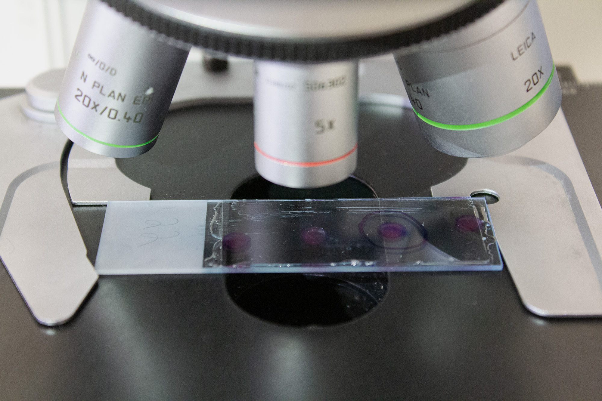 imagem de uma amostra no microscópio